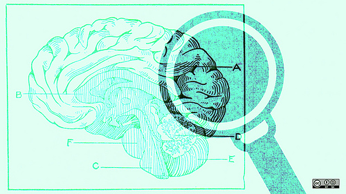 brain-stimulus-500-opt